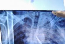 Arcanjo socorre vítima com um punhal no coração