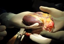 Transporte em avião da FAB pode evitar desperdício de órgãos doados