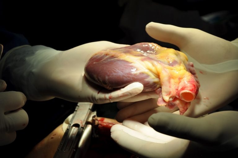 Transporte em avião da FAB pode evitar desperdício de órgãos doados