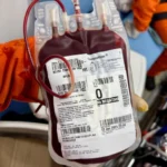 Criança com trauma grave é transferida por equipe aeromédica do SAAV de Arinos para Brasília