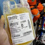 Criança com trauma grave é transferida por equipe aeromédica do SAAV de Arinos para Brasília